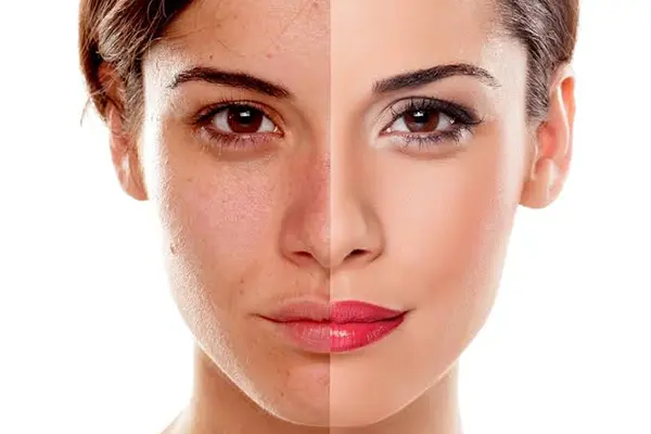 Photo Retouching Services